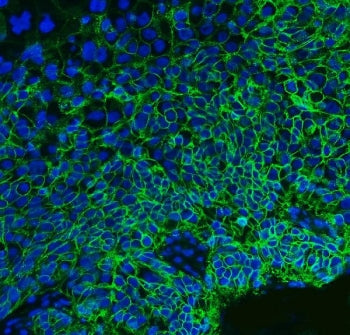 CD147 / Emmprin / Basigin Antibody