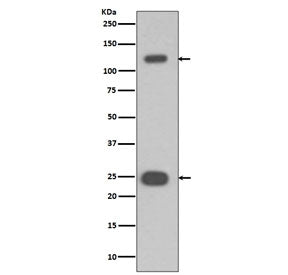 Western blot testing of human Jurkat cell lysate with PARP antibody. Predicted molecular weight ~116