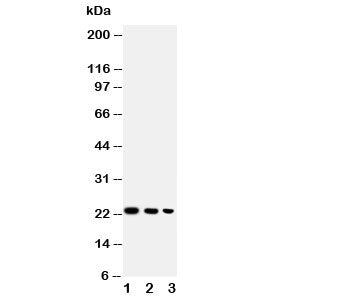 Western blot testing of BAFF antibody and Lane 1: recombinant human protein 10ng; 2: 5ng; 3: 2.5ng