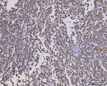 CCL14 Antibody / C-C motif chemokine 14