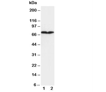 Western blot testing of COL3A1 antibody and Lane 1: HT1080; 2: COLO320 cell lysate. Expected molecul