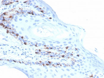 MART-1 / Melan-A Antibody