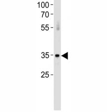 ATF7 Antibody