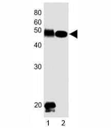 DLK1 Antibody