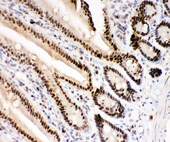 PARP Antibody