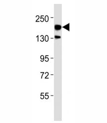 ERBB4 Antibody (HER4)