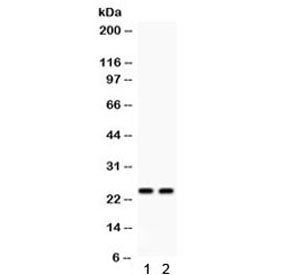 Lipocalin 2 Antibody / NGAL / LCN2