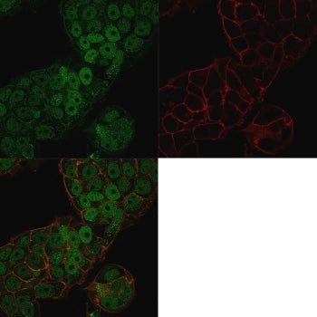 Immunofluorescent staining of permeabilized human MCF7 cells with CHD4 antibody (clone 3F2/4, green)