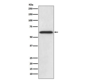Western blot testing of human HepG2 cell lysate with Catalase antibody. Predicted molecular weight ~