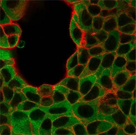 Immunofluorescent staining of human MCF-7 cells using IRF3 antibody (green, clone PCRP-IRF3-6C8) and