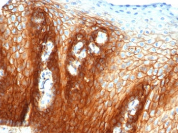 IHC staining of FFPE human esophagus tissue with CD44 antibody (clone rHCAM/6449). HIER: boil tissue