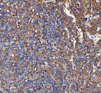 IHC staining of FFPE human spleen tissue with FERMT2 antibody. HIER: boil tissue sections in pH8 EDT