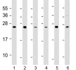 Western blot testing of 1) A549, 2) HCT116, 3) MCF-7, 4) NCI-H1299, 5) Raji and 6) THP-1 cell lysate