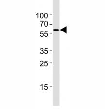 Western blot testing of Atg5 antibody at 1:4000 dilution + NIH3T3 lysate; ATG5: ~32 kDA; ATG5/ATG12 