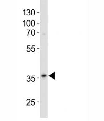 Western blot analysis of lysate from A375 cell line using anti-GAPDH antibody diluted at 1:500. Pred