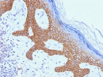 Desmoglein 3 Antibody / DSG3
