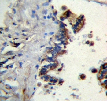 IHC testing of FFPE human lung tissue with Ficolin 3 antibody. HIER: steam section in pH6 citrate bu