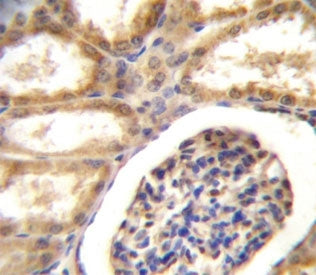 DDR1 antibody immunohsitochemistry analysis in formalin fixed and paraffin embedded human kidney tis