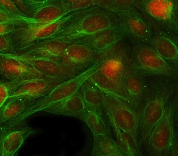 Retinol Binding Protein 1 Antibody / RBP1