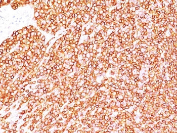 IHC staining of FFPE human tonsil tissue with CD45RB antibody (clone BRA-11). HIER: boil tissue sect