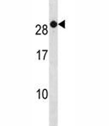 RAB7B Antibody