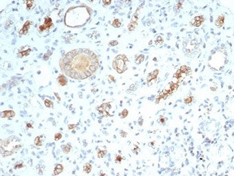 CFTR Antibody / Cystic Fibrosis Transmembrane Regulator