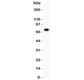 Western blot testing of 5-Lipoxygenase antibody and SGC lysate; Predicted molecular weight: ~78 kDa.