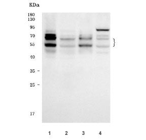 IKZF1 Antibody / IKAROS