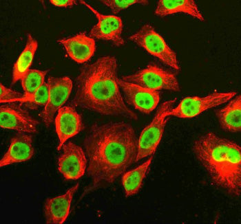 Immunofluorescent staining of RNF220 using anti-RNF220 antibody (green) and anti-Beta Tubulin antibo