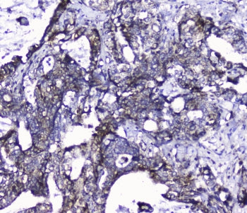 Cdk6 Antibody