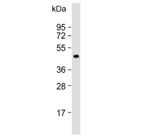 Western blot testing of human liver lysate with LYVE1 antibody. Expected molecular weight: 35-65 kDa