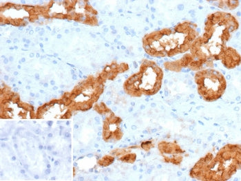 IHC staining of FFPE human tonsil tissue with CALB1 antibody (clone KR6). Inset: PBS used in place o