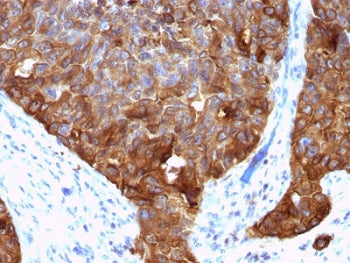 MUC1 Antibody / Mucin-1