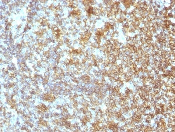CD45 Antibody (Leukocyte marker)