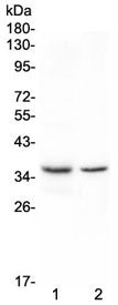 Western blot testing of 1) rat spleen and 2) rat thymus with Cd8a antibody at 0.5ug/ml. Expected mol