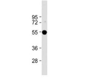 Western blot testing of FADS2 antibody at 1:2000 + human liver lysate. Predicted molecular weight ~5