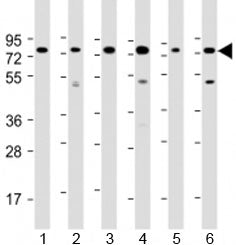 Western blot testing of human 1) Daudi, 2) HepG2, 3) Jurkat, 4) K562, 5) MOLT-4 and 5) Raji cell lys