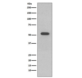 Western blot testing of human A431 cell lysate with Keratin 10 antibody. Predicted molecular weight 