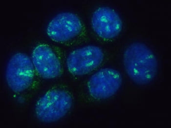 TMEM50B Antibody / Transmembrane protein 50B / C21orf4