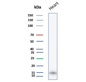 Western blot testing of human heart lysate with FABP3 antibody. Predicted molecular weight ~14 kDa.