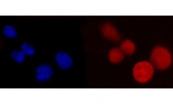 PCBP2 Antibody / hnRNP E2