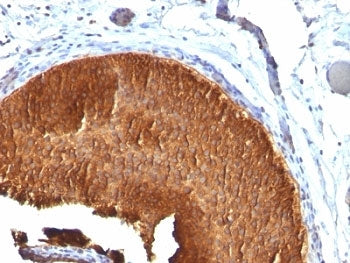 KRT19 Antibody / Cytokeratin 19