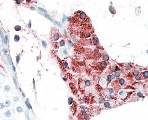 IHC testing of FFPE human testis with TIAM2 antibody at 5ug/ml. HIER: steamed with pH6 citrate buffe
