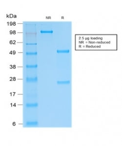 SDS-PAGE analysis of purified, BSA-free recombinant SOX9 antibody (clone SOX9/2287R) as confirmation