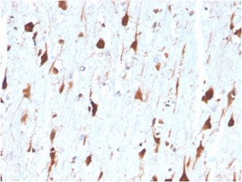 CA8 Antibody / Carbonic Anhydrase VIII
