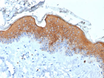 KRT10 Antibody / Cytokeratin 10