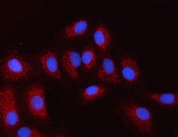 Immunofluorescent staining of FFPE human A549 cells with PXK antibody (red) and DAPI nuclear stain (
