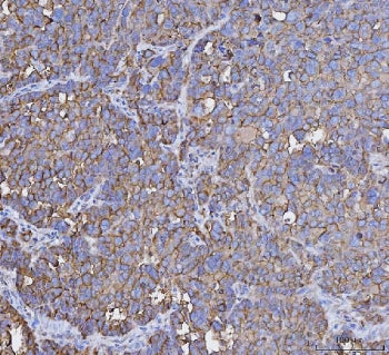 MUC1 Antibody / Mucin-1
