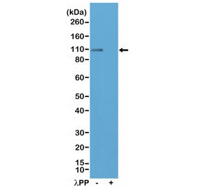 Western blot testing of lysate from mouse brain tissue, untreated (-) or dephosphorylated (+) with L
