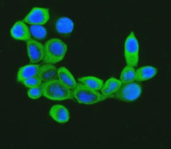 Cofilin 1 Antibody